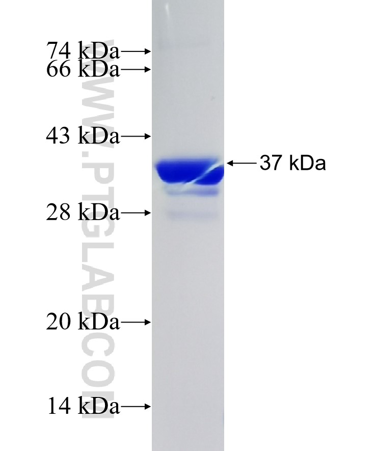 TERT fusion protein Ag26270 SDS-PAGE