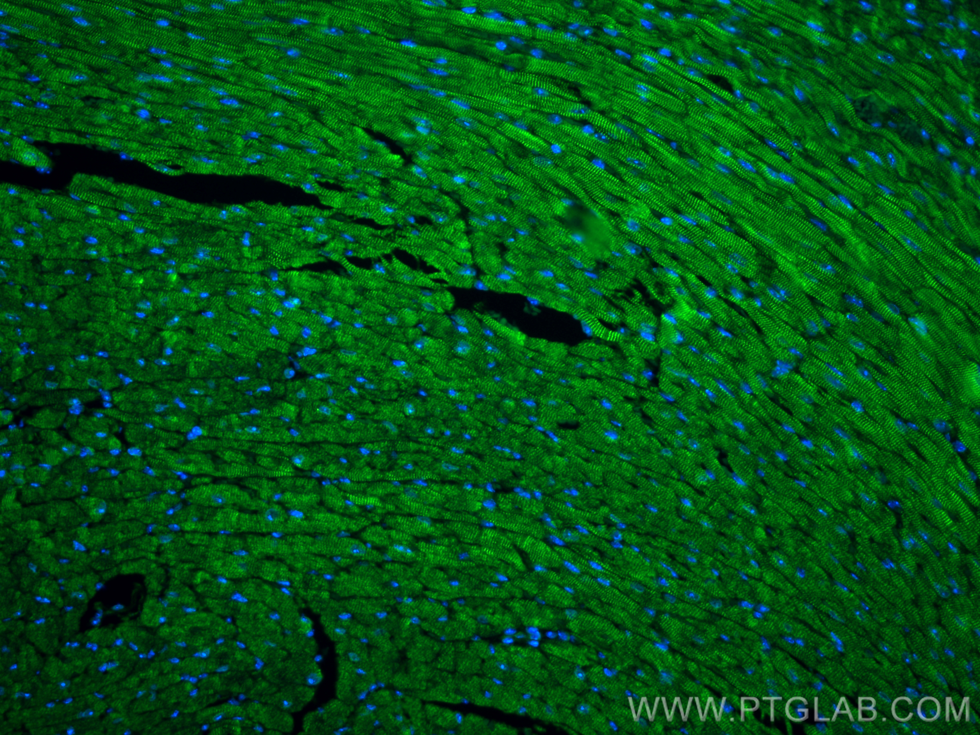 IF Staining of mouse heart using 10258-1-AP