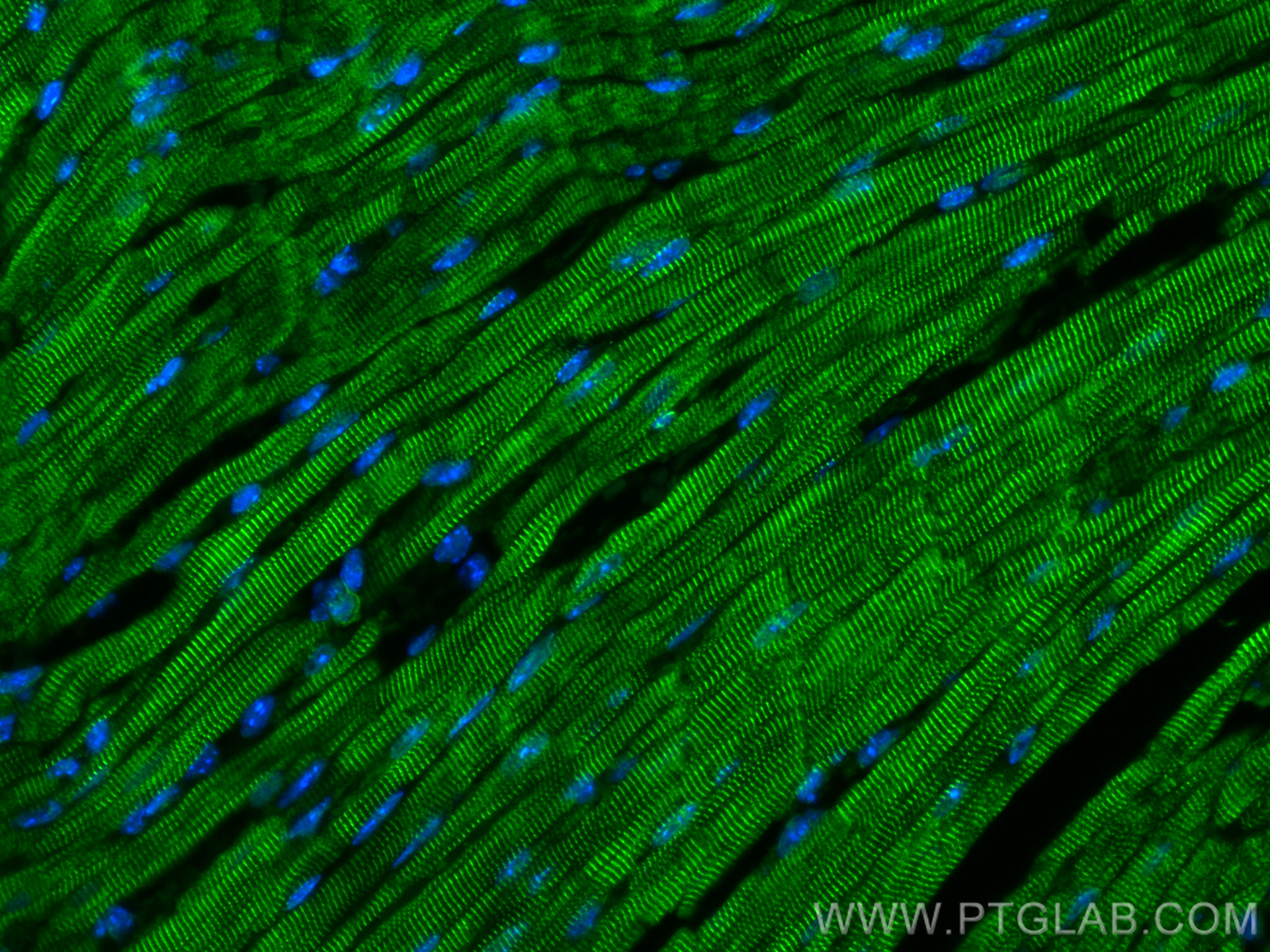 IF Staining of mouse heart using 10258-1-AP