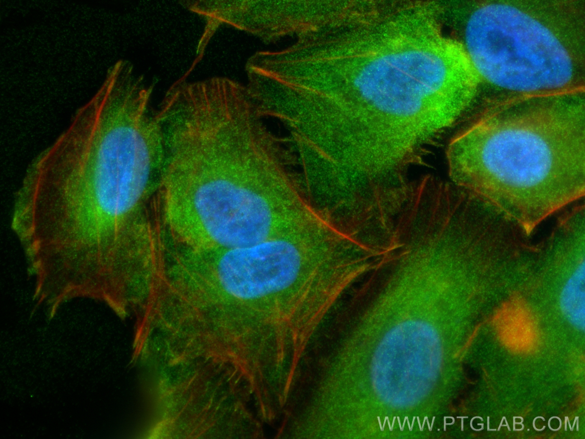 IF Staining of A549 using 10258-1-AP