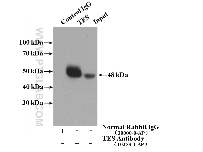 IP experiment of K-562 using 10258-1-AP