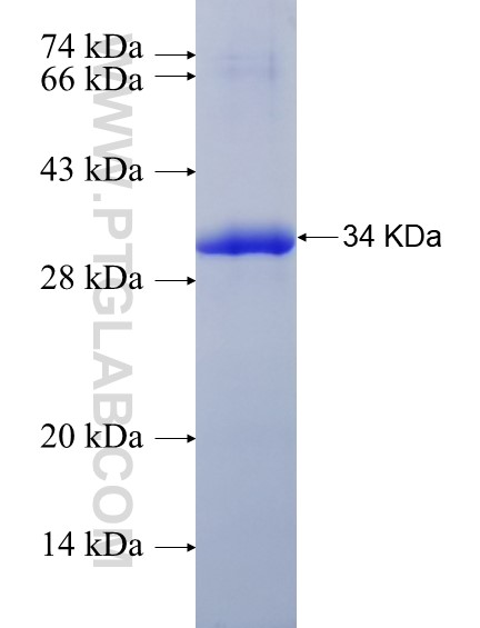 TES fusion protein Ag28548 SDS-PAGE