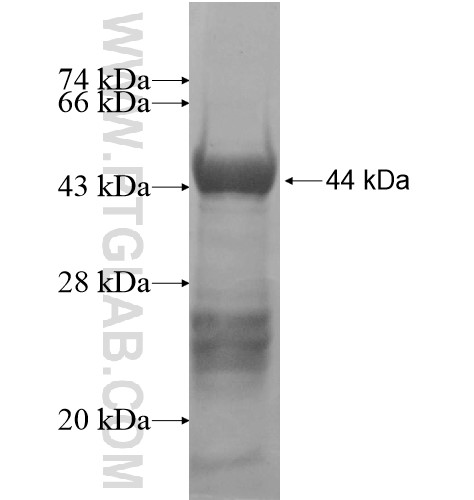 TESK2 fusion protein Ag11249 SDS-PAGE TESK2 fusion protein Ag11249 SDS-PAGE