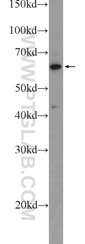 WB analysis of A431 using 25975-1-AP