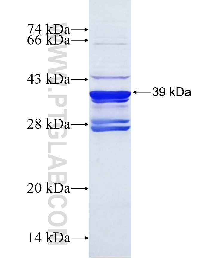 TET1 fusion protein Ag40528 SDS-PAGE TET1 fusion protein Ag40528 SDS-PAGE