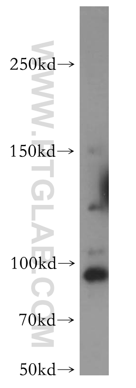 WB analysis of HeLa using 17372-1-AP