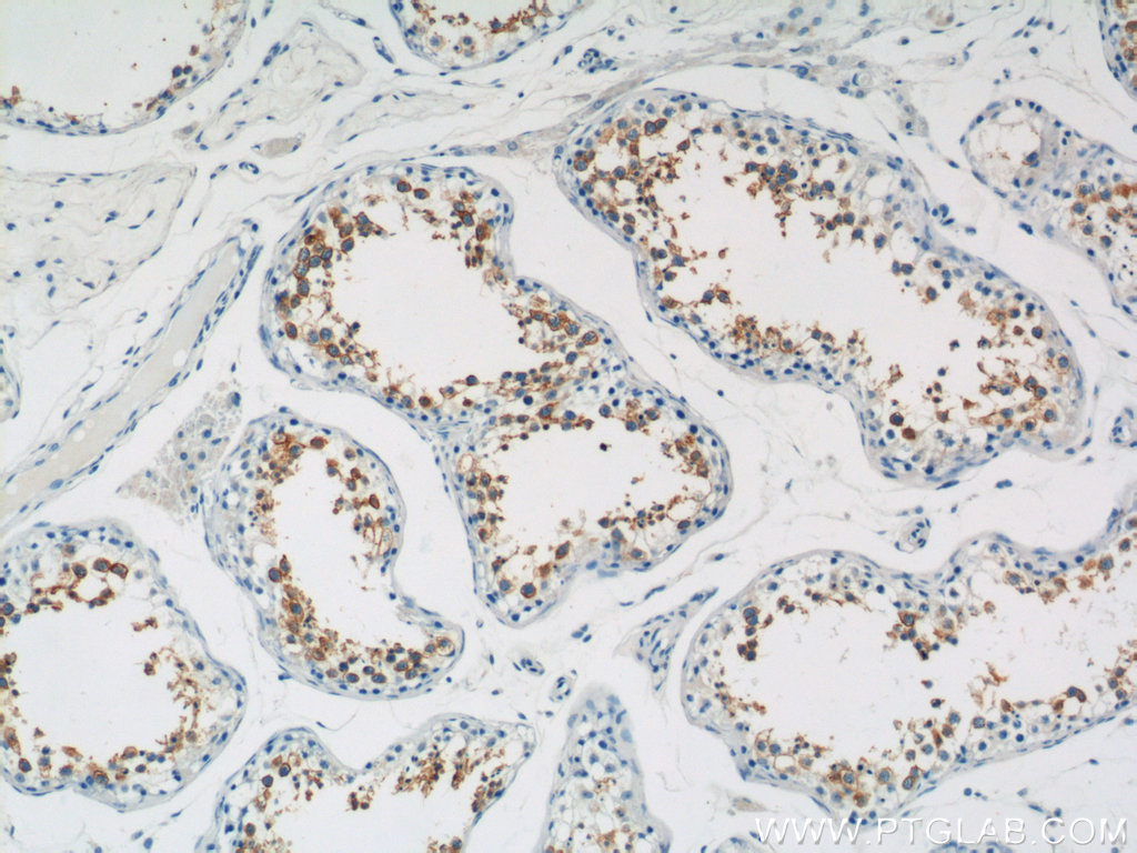 IHC staining of human testis using 15447-1-AP