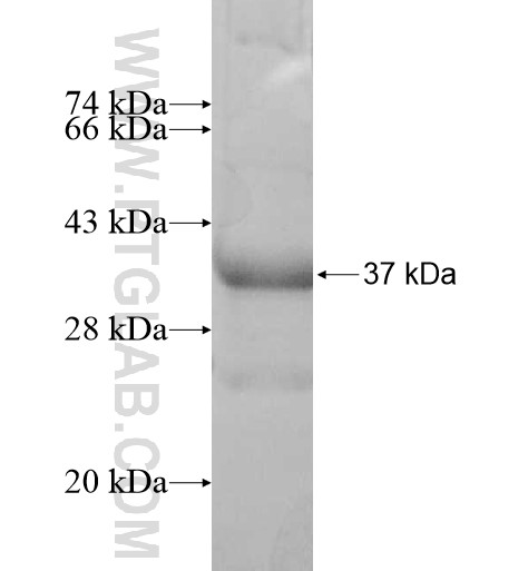 TEX101 fusion protein Ag12392 SDS-PAGE TEX101 fusion protein Ag12392 SDS-PAGE
