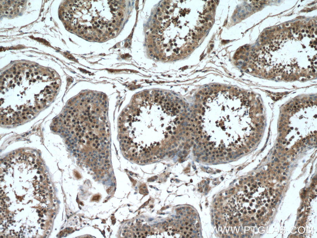 IHC staining of human testis using 17068-1-AP