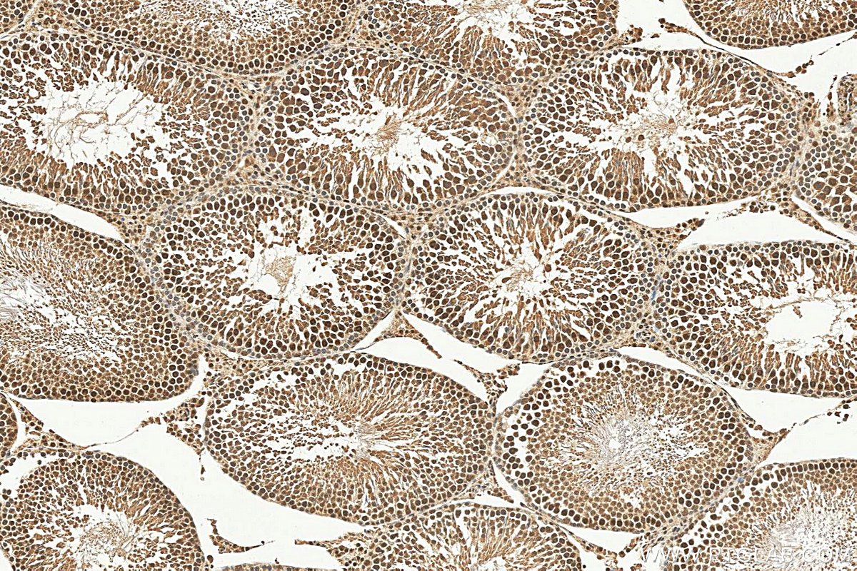 IHC staining of rat testis using 17068-1-AP IHC staining of rat testis using 17068-1-AP