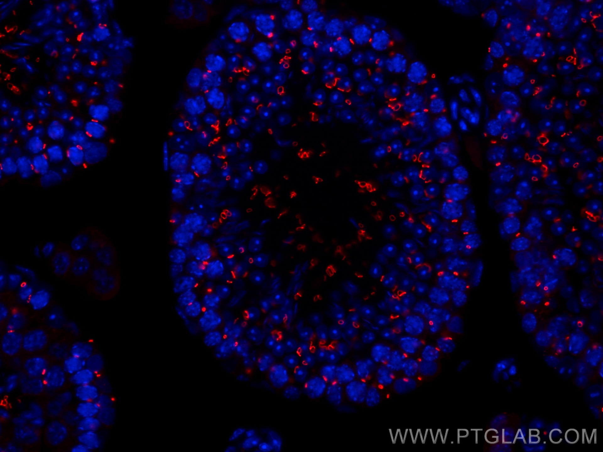 IF Staining of mouse testis using CL594-67982