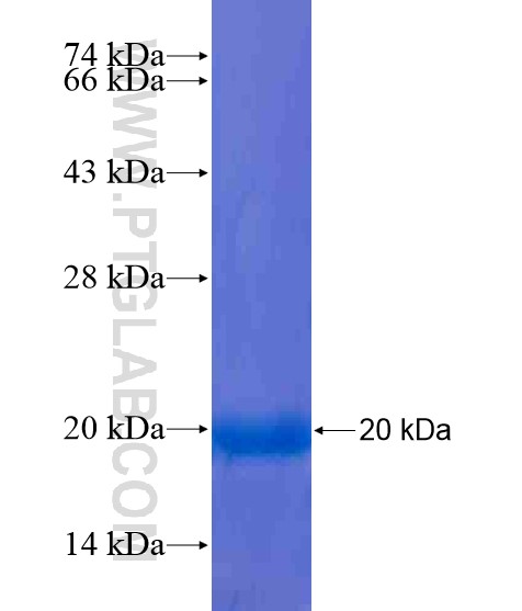TEX15 fusion protein Ag20490 SDS-PAGE TEX15 fusion protein Ag20490 SDS-PAGE