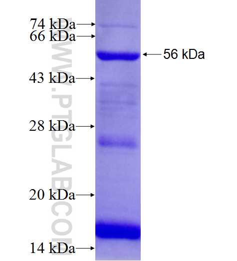 TEX2 fusion protein Ag8305 SDS-PAGE TEX2 fusion protein Ag8305 SDS-PAGE