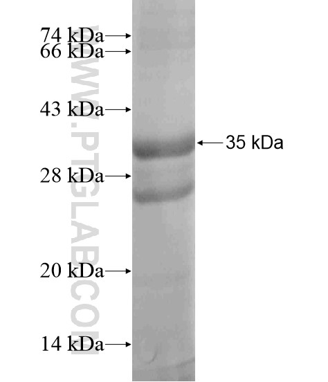 TEX261 fusion protein Ag19093 SDS-PAGE TEX261 fusion protein Ag19093 SDS-PAGE