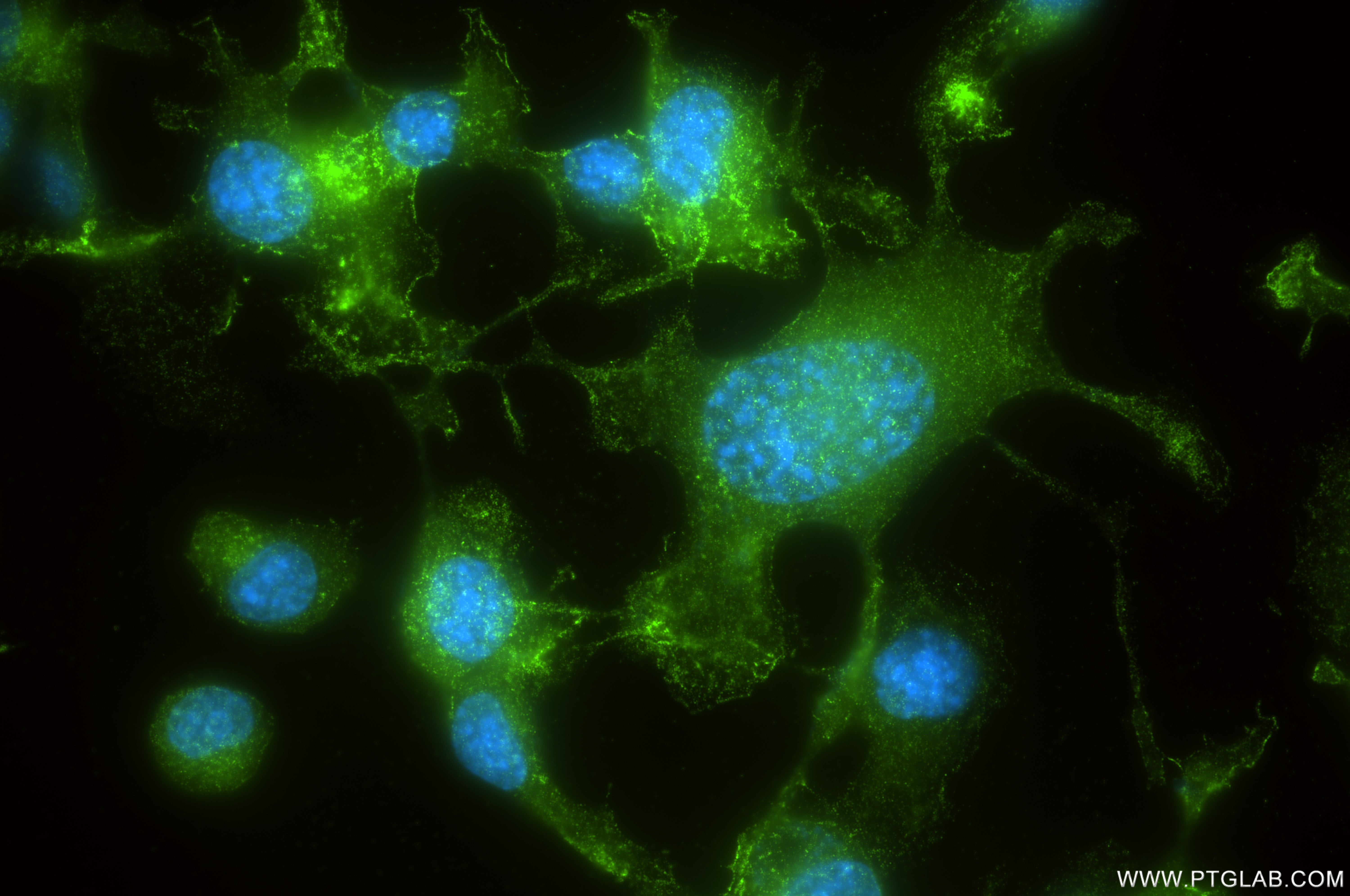 Immunofluorescent analysis of (-20°C Ethanol) fixed Neuro-2a cells using TEX264 antibody (84946-5-RR, Clone: 242500B3 ) at dilution of 1:400 and CoraLite®488-Conjugated Goat Anti-Rabbit IgG(H+L) (<a class='green' href='/productredirect?CatalogNo=SA00013-2' target='_blank'>SA00013-2</a>). IF Staining of Neuro-2a using 84946-5-RR
