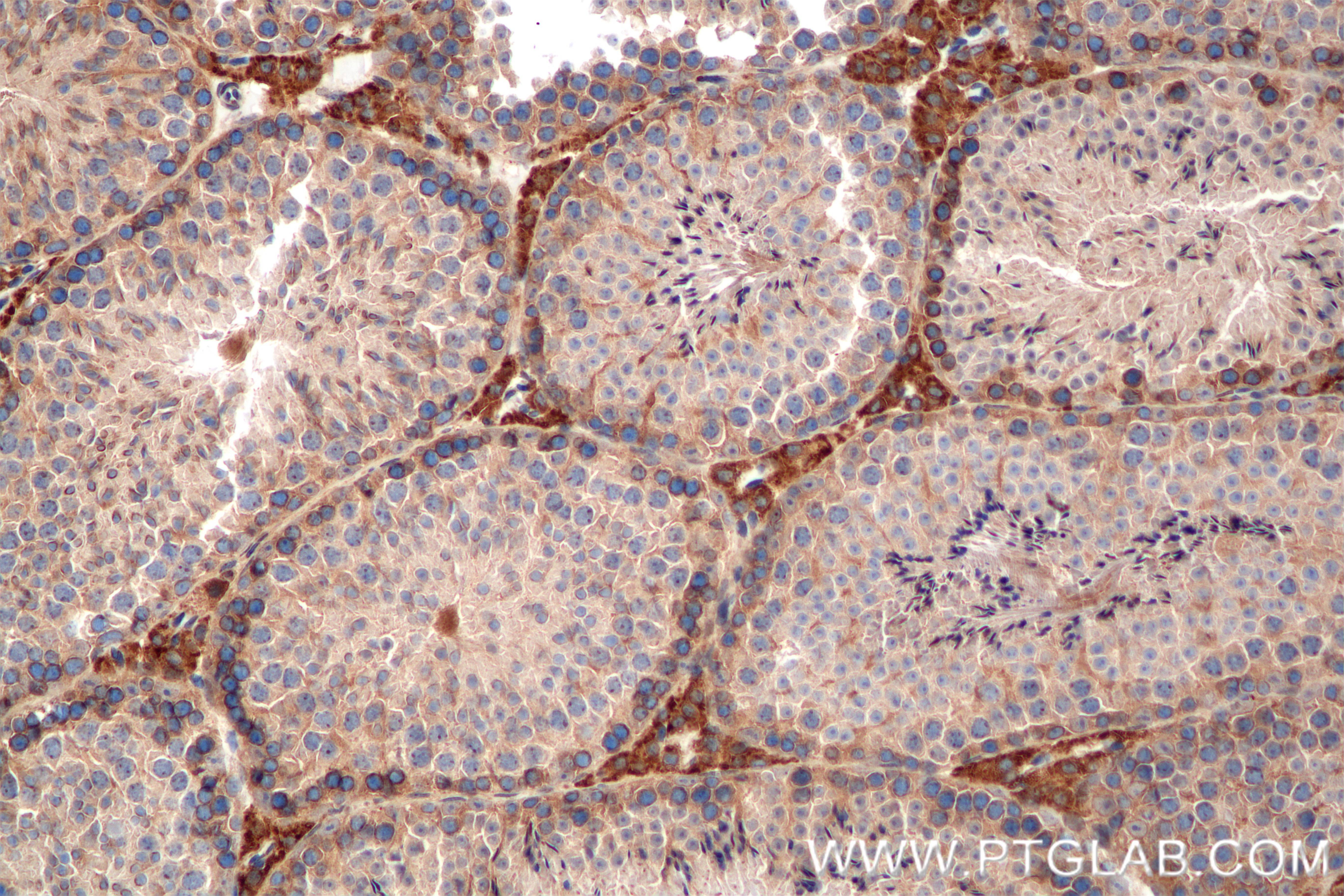 Immunohistochemical analysis of paraffin-embedded mouse testis tissue slide using 84946-5-RR (TEX264 antibody) at dilution of 1:200 (under 20x lens). Heat mediated antigen retrieval with Tris-EDTA buffer (pH 9.0). IHC staining of mouse testis using 84946-5-RR