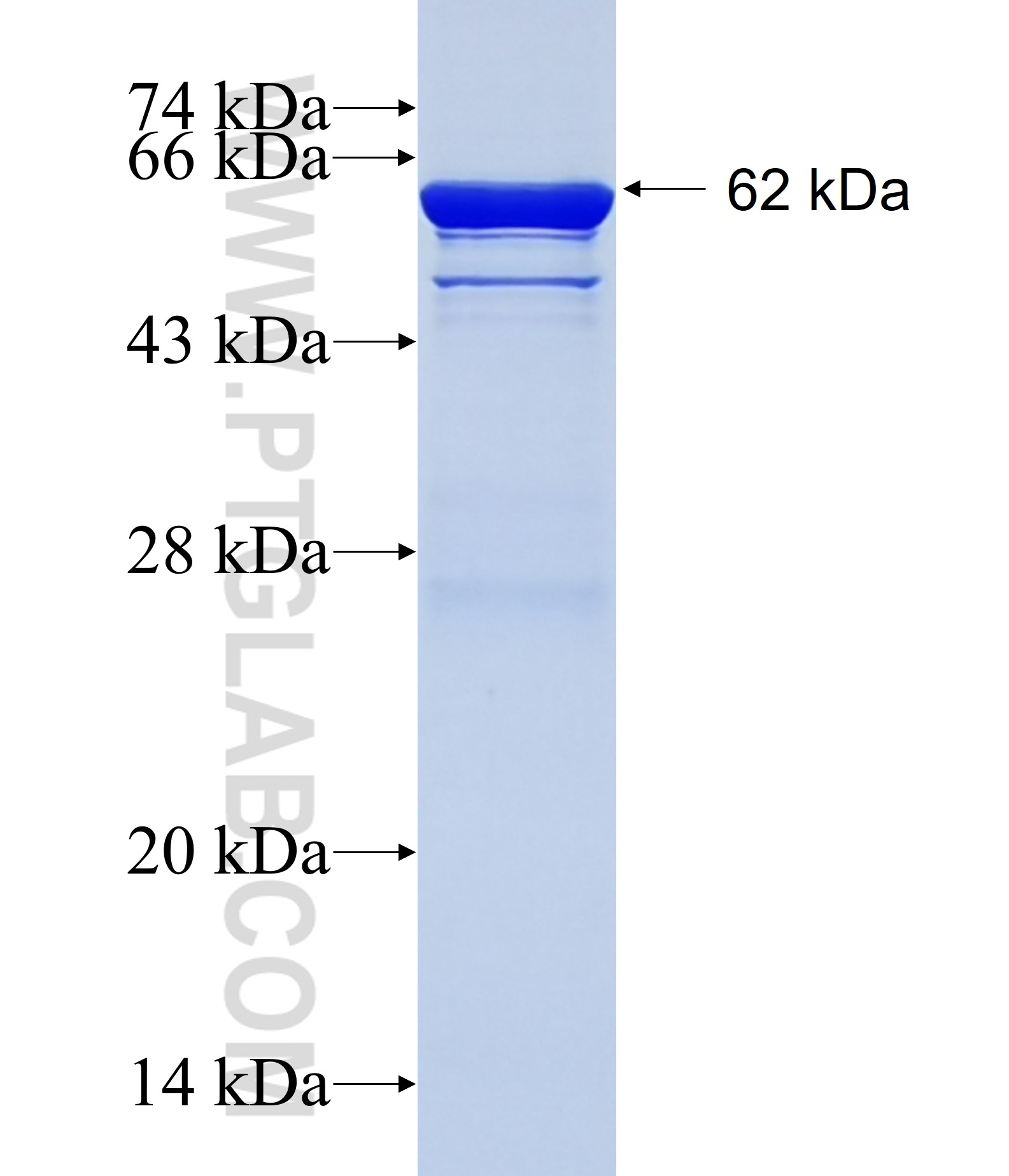 TEX264 fusion protein Ag23027 SDS-PAGE