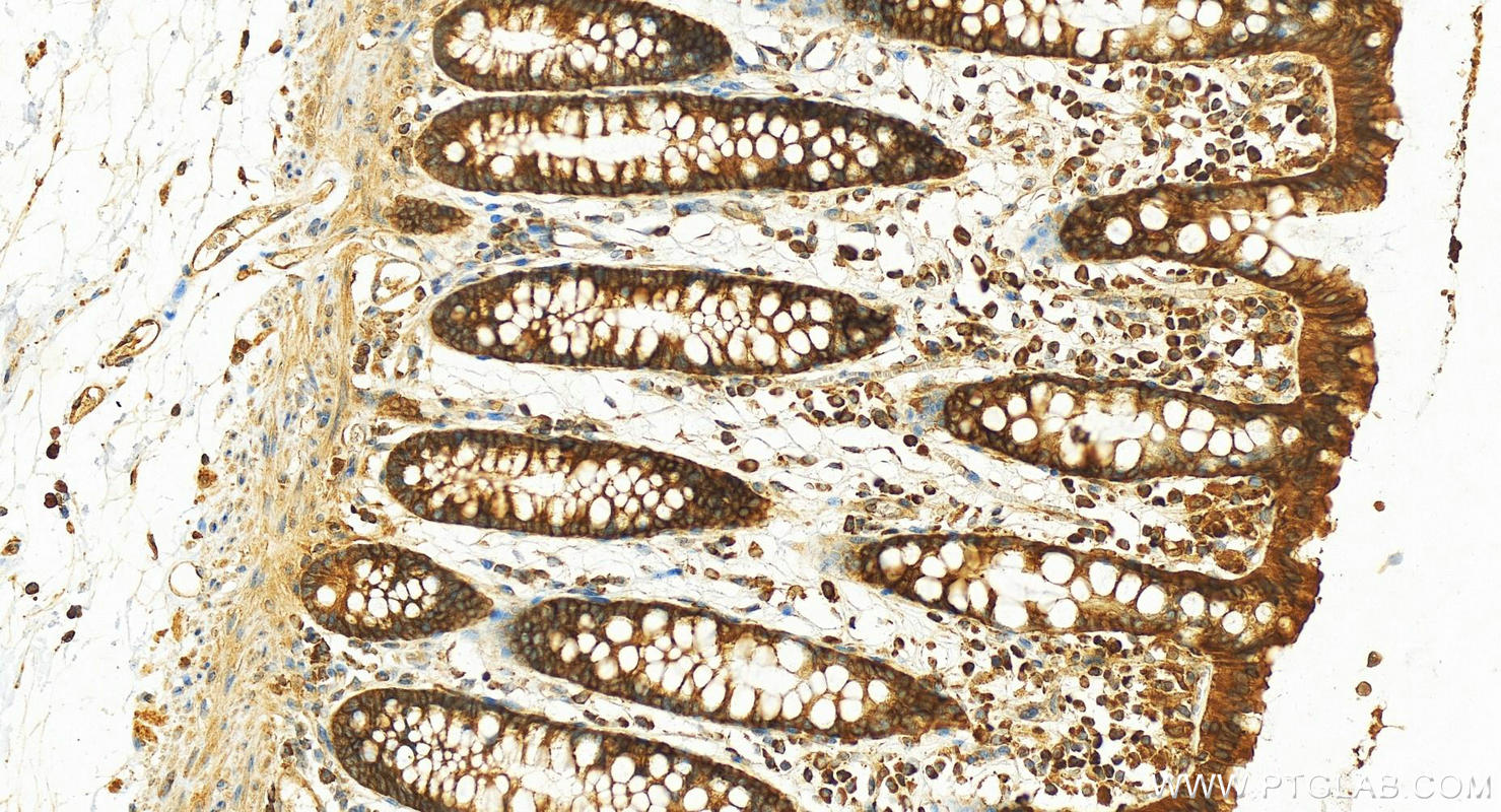 IHC staining of human colon using 17435-1-AP (same clone as 17435-1-PBS)