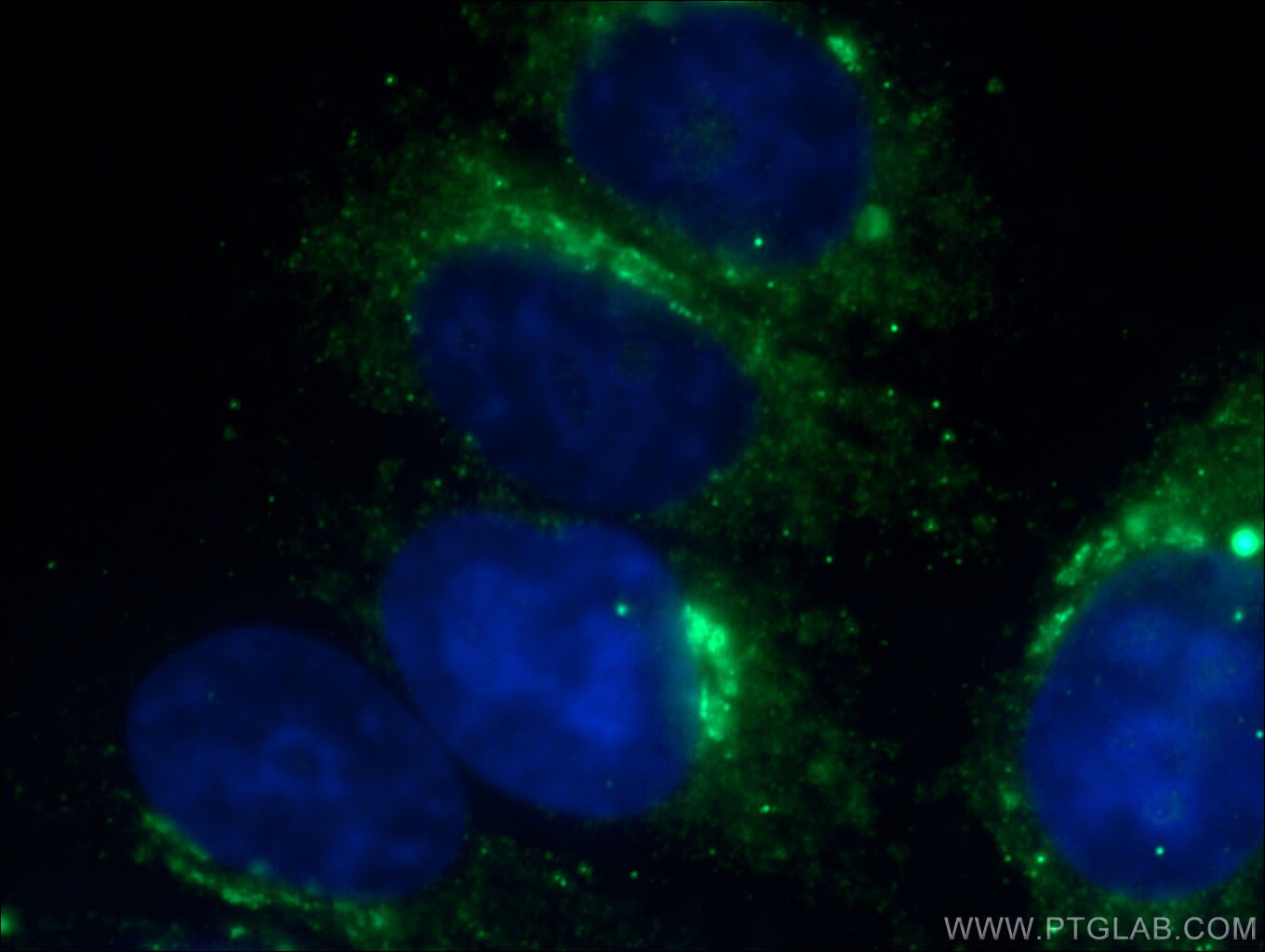 IF Staining of HepG2 using 17435-1-AP (same clone as 17435-1-PBS)