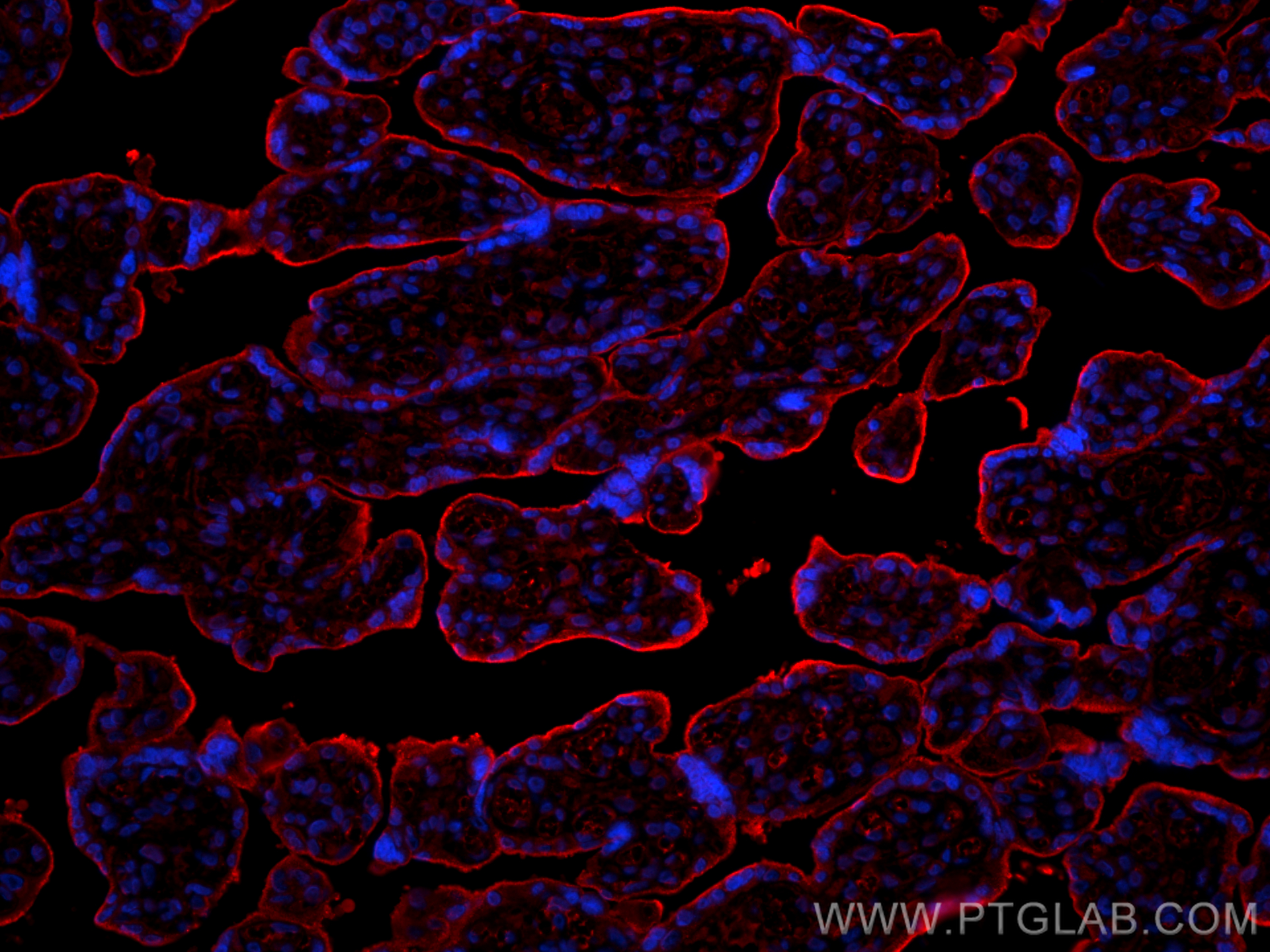 IF Staining of human placenta using 17435-1-AP (same clone as 17435-1-PBS)