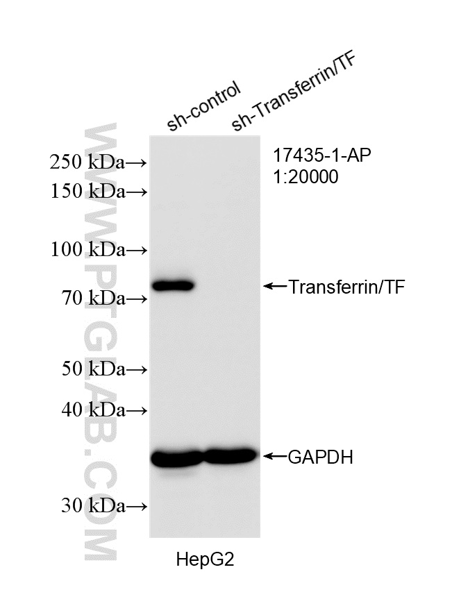 WB result of Transferrin/TF antibody (17435-1-AP; 1:20000; incubated at room temperature for 1.5 hours) with sh-Control and sh-Transferrin/TF transfected HepG2 cells. WB analysis of HepG2 using 17435-1-AP