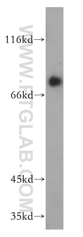 Transferrin Polyclonal antibody