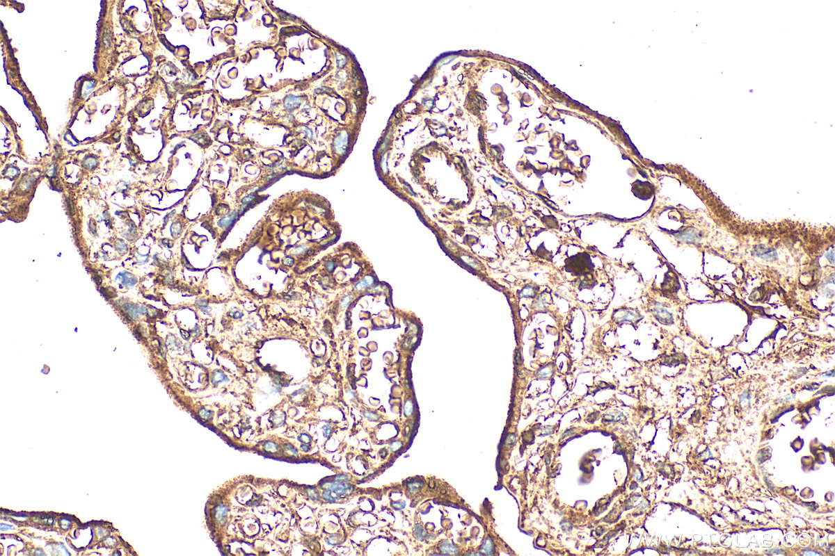 IHC staining of human placenta using 30337-1-AP