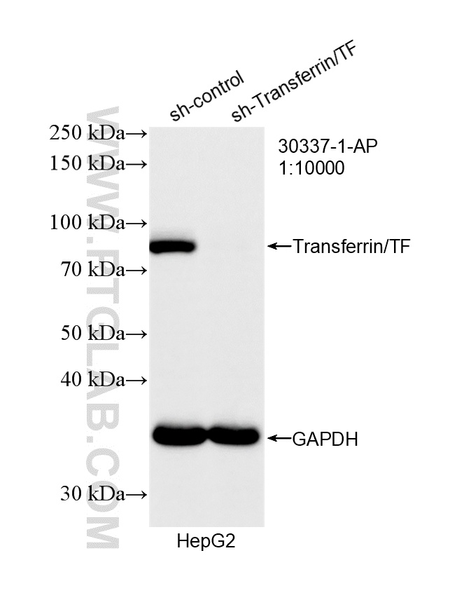 WB result of Transferrin/TF antibody (30337-1-AP; 1:10000; incubated at room temperature for 1.5 hours) with sh-Control and sh-Transferrin/TF transfected HepG2 cells. WB analysis of HepG2 using 30337-1-AP