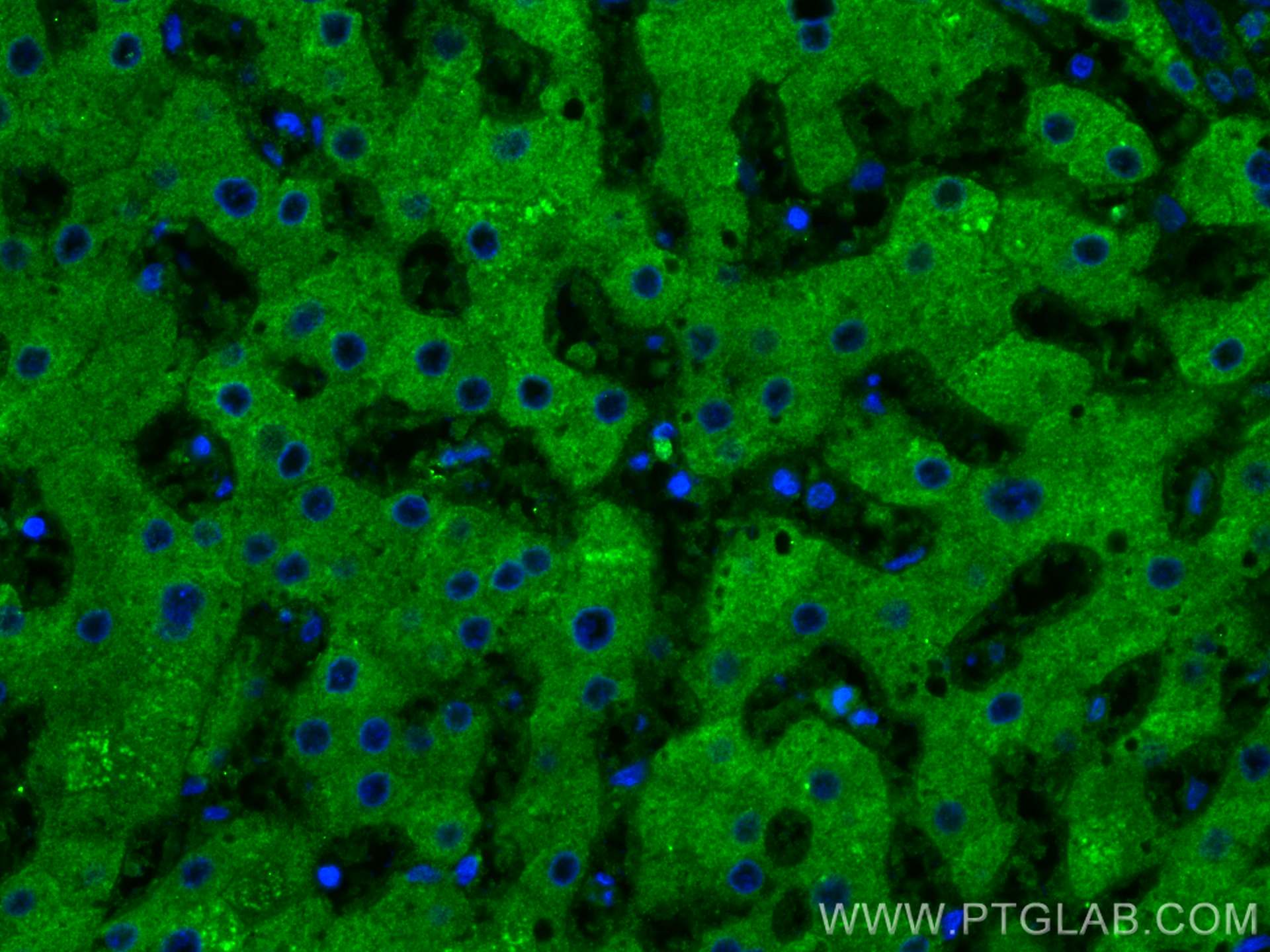 IF Staining of human liver using 66171-1-Ig