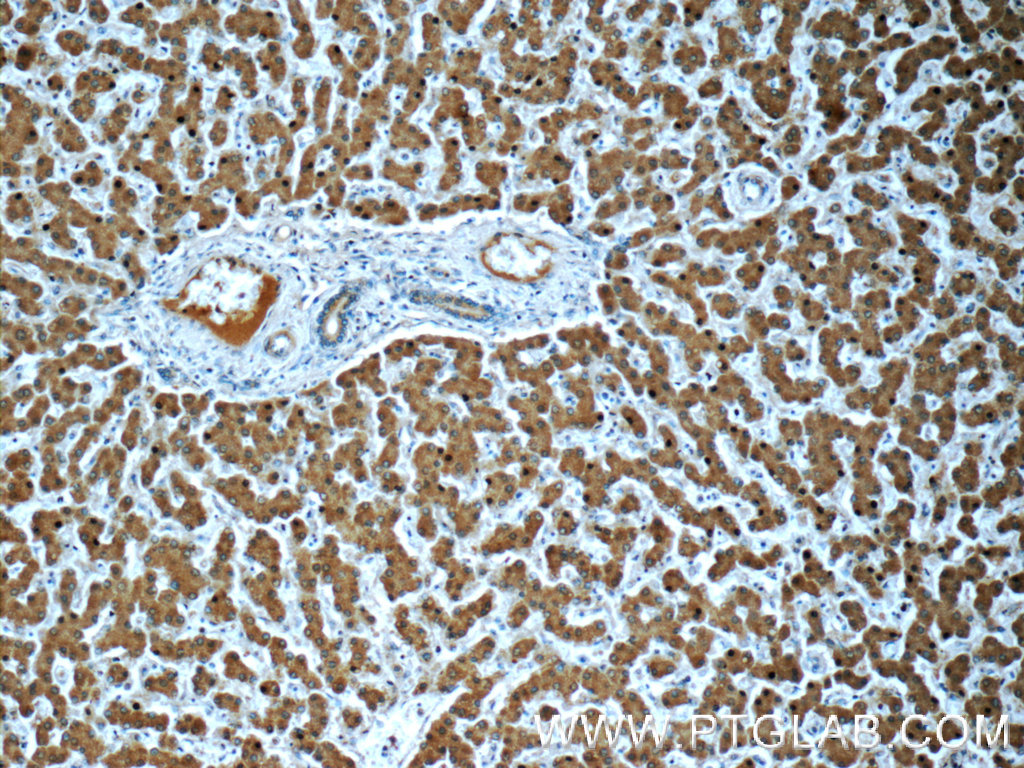 Transferrin Monoclonal antibody