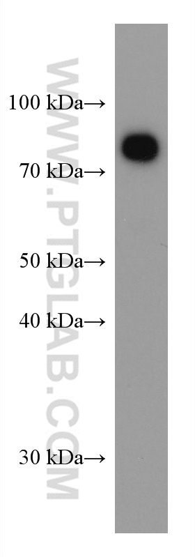 WB analysis of human plasma using 66171-1-Ig (same clone as 66171-1-PBS)