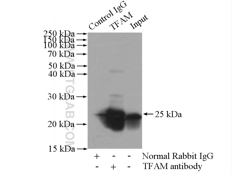 IP experiment of HEK-293 using 22586-1-AP