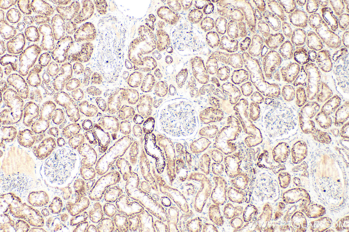 Immunohistochemical analysis of paraffin-embedded human kidney tissue slide using 23996-1-AP (TFAM antibody) at dilution of 1:400 (under 10x lens). Heat mediated antigen retrieval with Tris-EDTA buffer (pH 9.0). IHC staining of human kidney using 23996-1-AP