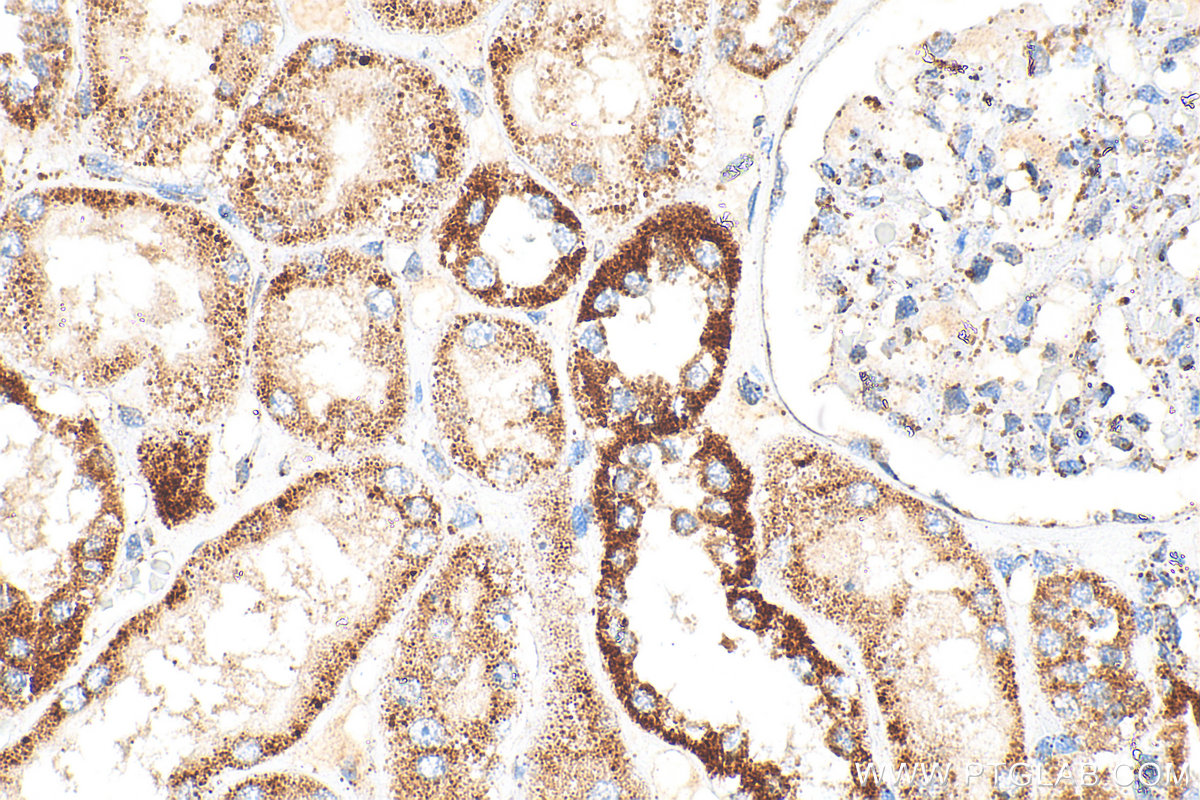 Immunohistochemical analysis of paraffin-embedded human kidney tissue slide using 23996-1-AP (TFAM antibody) at dilution of 1:400 (under 40x lens). Heat mediated antigen retrieval with Tris-EDTA buffer (pH 9.0). IHC staining of human kidney using 23996-1-AP