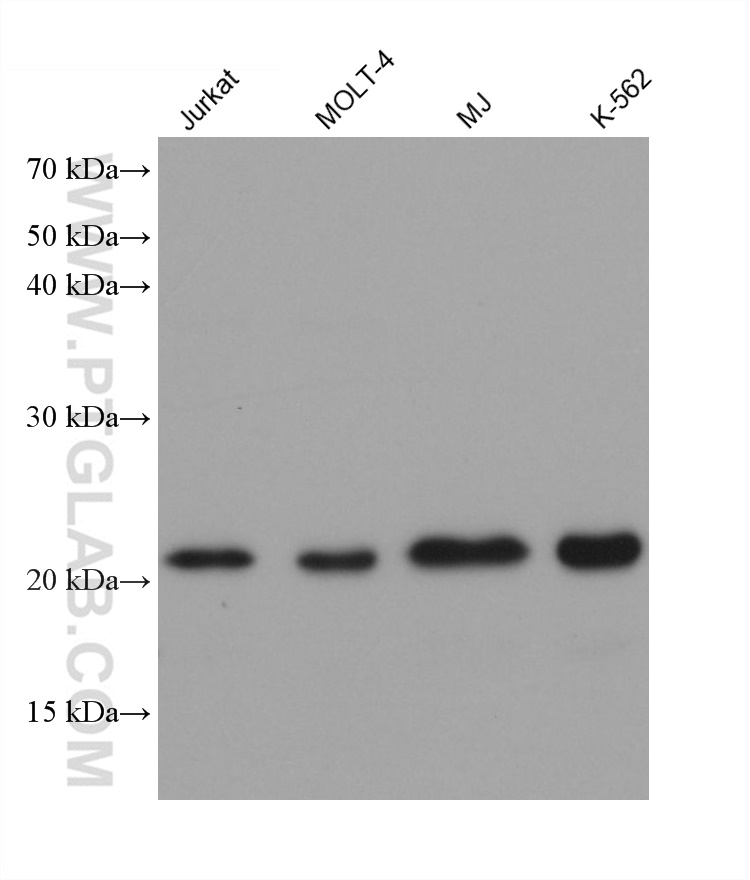 WB analysis using 68557-5-Ig