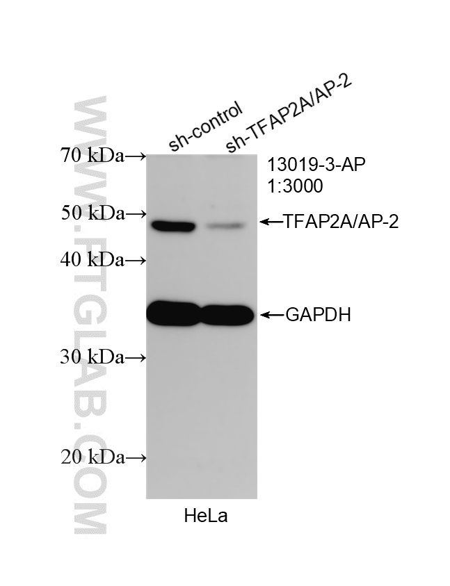 WB analysis of HeLa using 13019-3-AP WB analysis of HeLa using 13019-3-AP