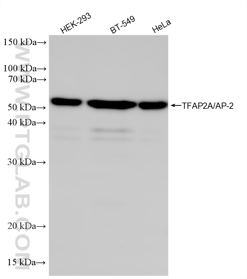 WB analysis using 87936-1-RR WB analysis using 87936-1-RR
