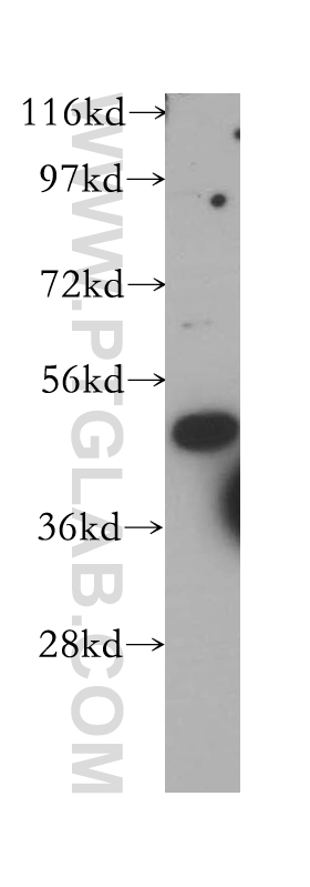 WB analysis of HeLa using 14572-1-AP