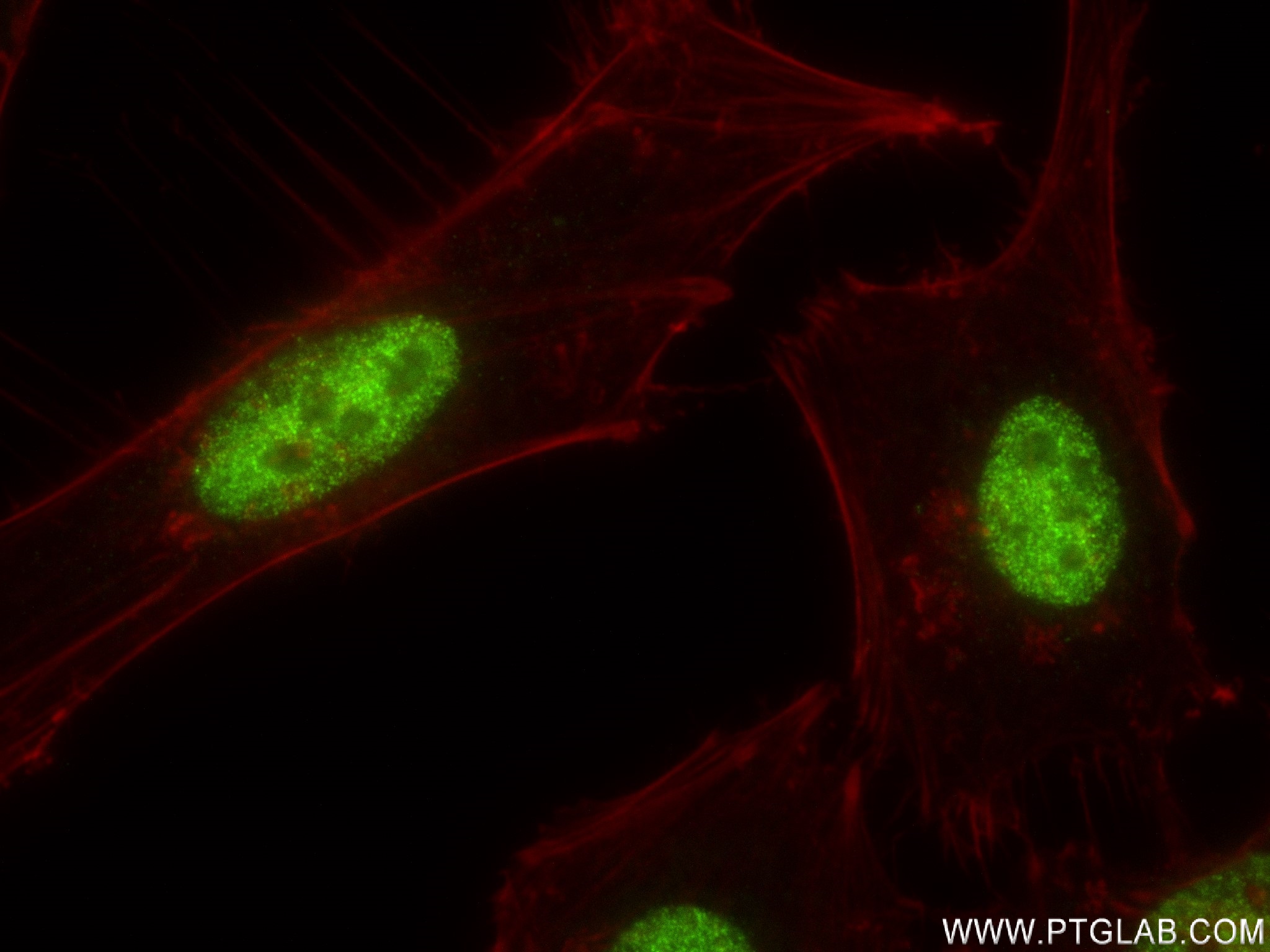 IF Staining of HeLa using 83196-4-RR