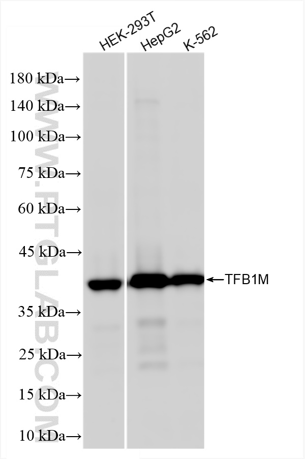 TFB1M