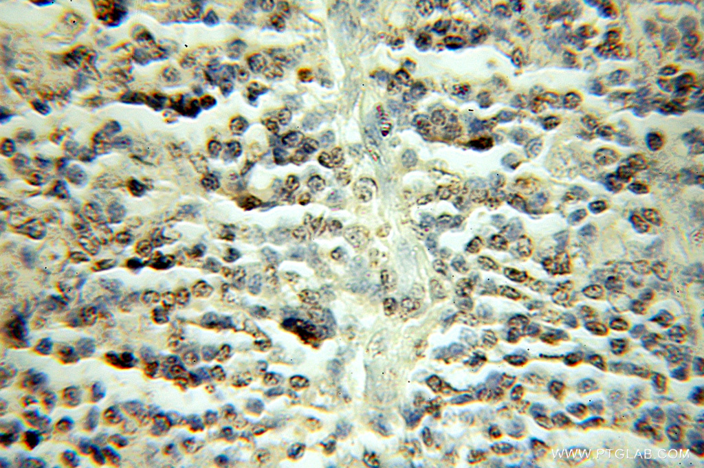 TFDP1 Polyclonal antibody