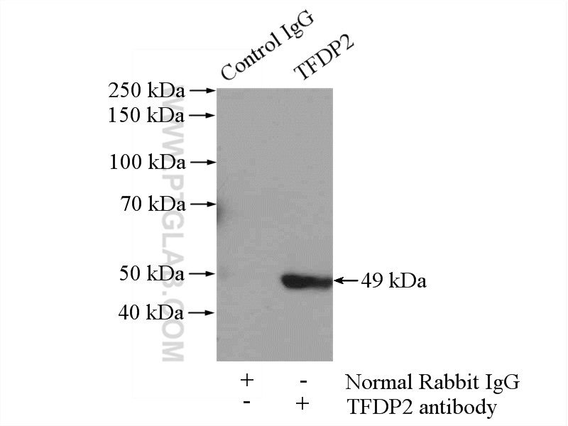 IP experiment of SH-SY5Y using 11500-1-AP