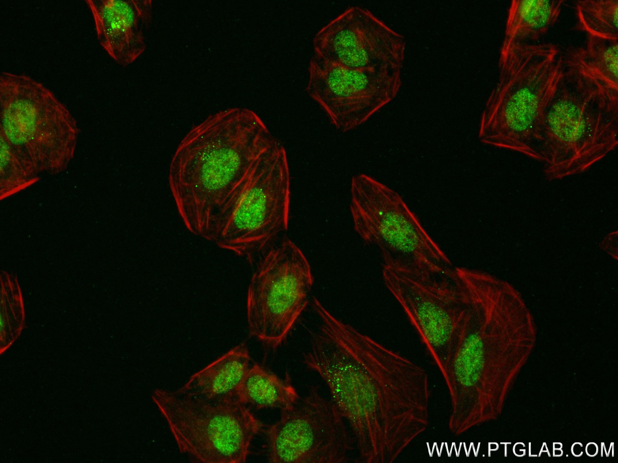 IF Staining of U2OS using 84408-4-RR (same clone as 84408-4-PBS)