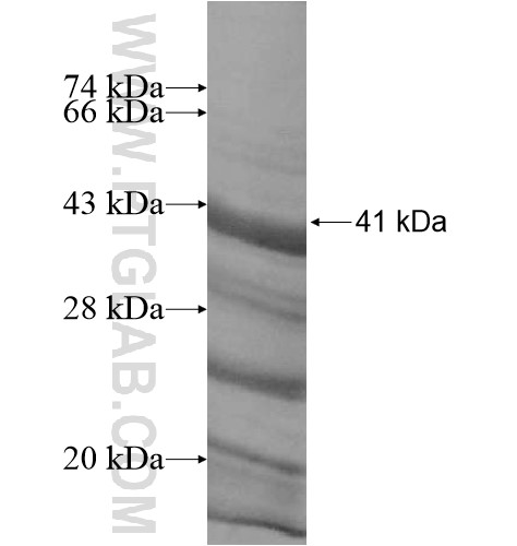 TFDP3 fusion protein Ag12474 SDS-PAGE TFDP3 fusion protein Ag12474 SDS-PAGE