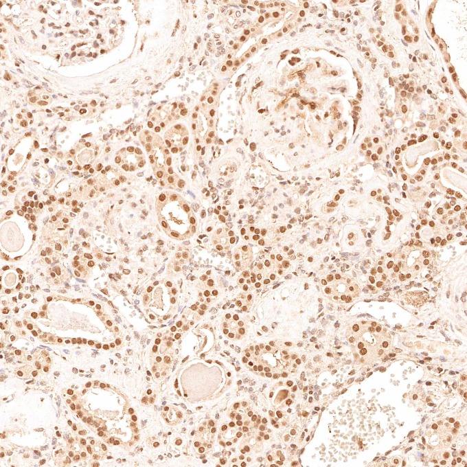 IHC staining of human kidney using 67319-1-Ig IHC staining of human kidney using 67319-1-Ig