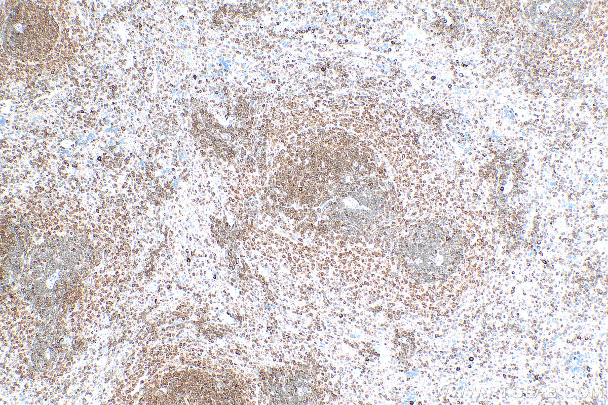 IHC staining of rat spleen using 13372-1-AP