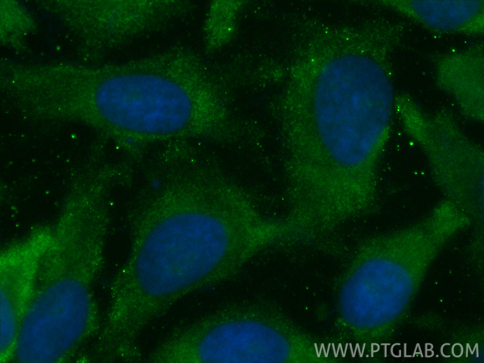 Immunofluorescent analysis of (-20°C Methanol) fixed HeLa cells using CoraLite® Plus 488 TFEB antibody (CL488-84675-5, Clone: 242093D11 ) at dilution of 1:200. IF Staining of HeLa using CL488-84675-5
