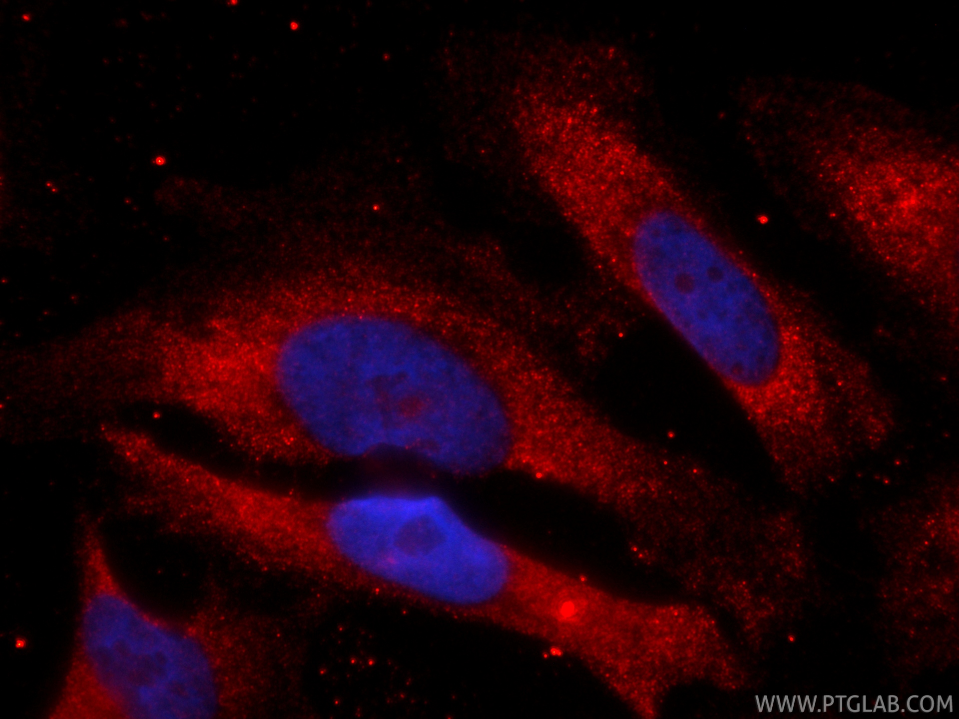 IF Staining of HeLa using CL594-84675-5