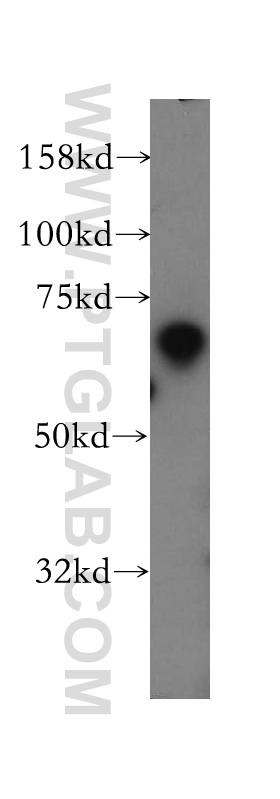 WB analysis of mouse testis using 13547-1-AP