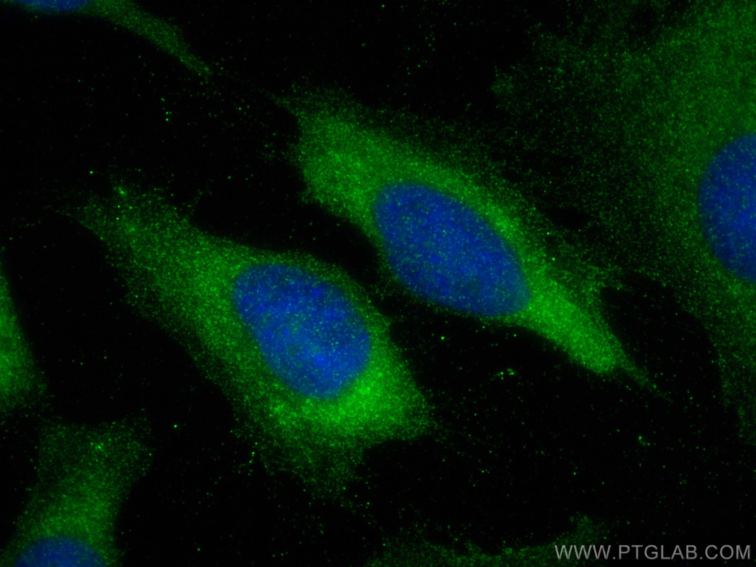 IF Staining of HeLa using 13734-1-AP